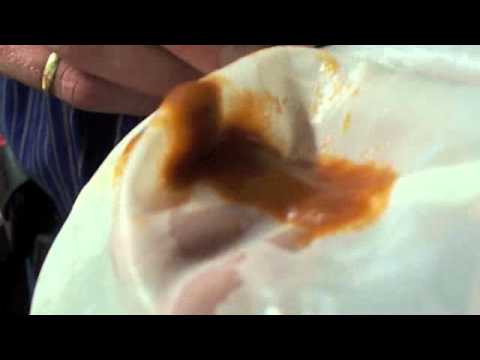 how to harvest artemia