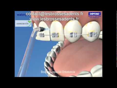 Solution Orthodontique du laboratoire Dentaid_Tu higiene bucal diaria Ortodoncia.flv