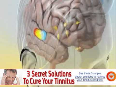 zinc treatment for tinnitus