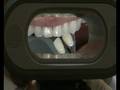 videos de Optilume Trueshade