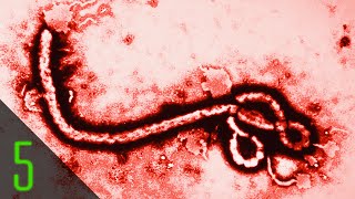 5 Terrifying Facts About Ebola