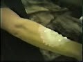 zombie arm make up