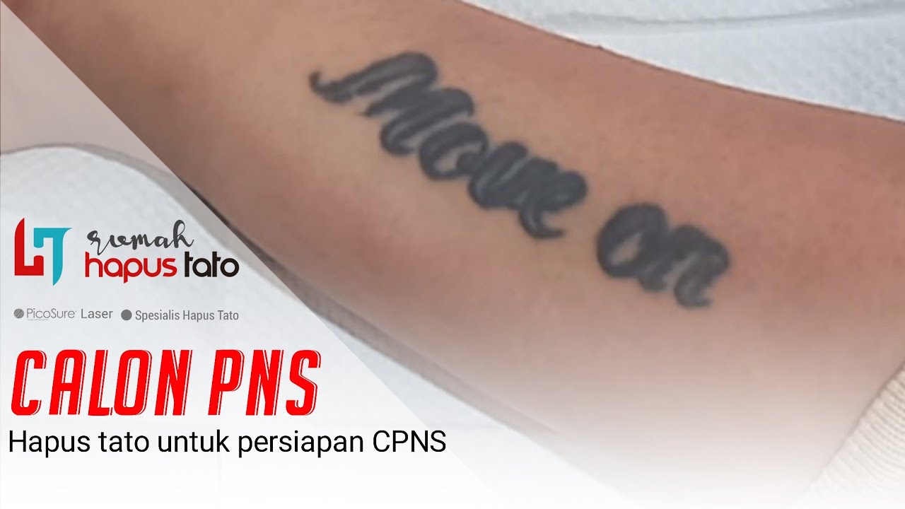 Hapus Tato Tinta Hitam Di Lengan | Rumah Hapus Tato