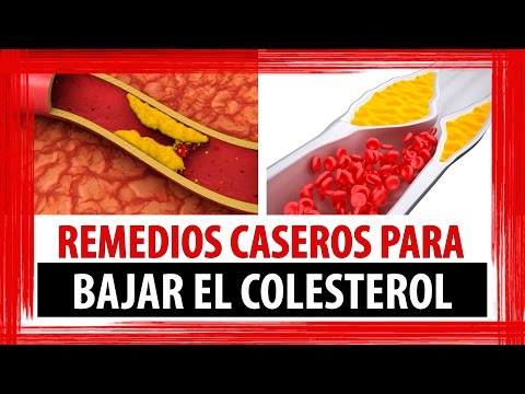 Cómo Preparar Remedios Caseros para Bajar el Colesterol Cómo Preparar Remedios Caseros para Bajar el Colesterol