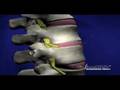 SpineMed Decompression Table Spine Med