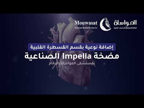 Impella مضخة بقسم القلب بمستشفى المواساة بالدمام