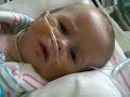 Matthew is doing well after his open heart surgery on 9/2.  He was extubated today and put on nasal canula and he's doing well
