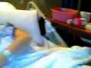 my cast/surgery