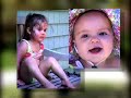 Karen Becker's experience as a Whipple Patient