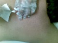 a cirurgia parte 4.mp4