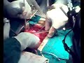 cardiothoracic surgery CMC