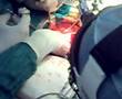 cardiothoracic surgery CMC