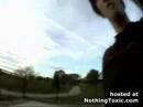 BMX Faceplant Results in Loss of Teeth