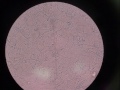 Heavy Metal Mycology Heavy Metal Mycology