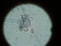 Heavy Metal Mycology