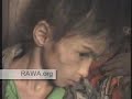 7 year old Afganni girl beaten by her inlawsfor two years