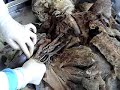 anatomia, plexo braquial anatomia, plexo braquial