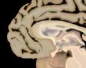 Brain Brain