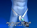 http://www.arijal.com/أي تكبير القضيب بدون عملية جراحيةتقرير التلفزيون الألماني الأول 
