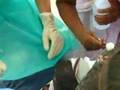 The Leprosy Colony