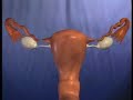 Tubal Ligation Reversal by Dr. Berger Tubal Ligation Reversal by Dr. Berger