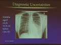 21st Century Bacterial Pneumonia: Old Habits and New Approaches  Pneumonia Respiratory Diseases