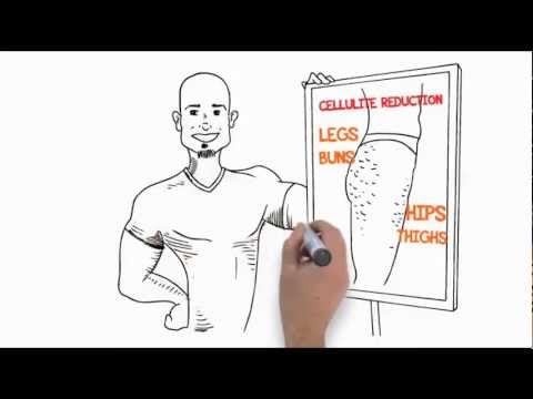 how to relieve cellulitis pain