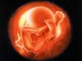 Vídeo - Aborto