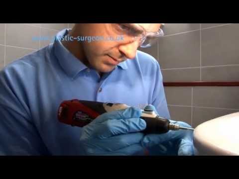 how to re-enamel a belfast sink