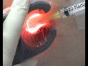 Sclerotherapy