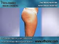 Mesotherapy Treatment Mesotherapy Treatment