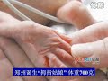 郑州诞生拇指婴儿体重仅700克