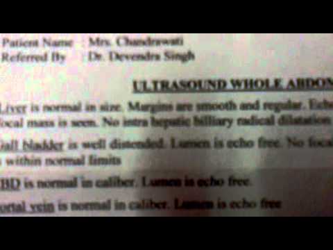 how to cure appendix without operation