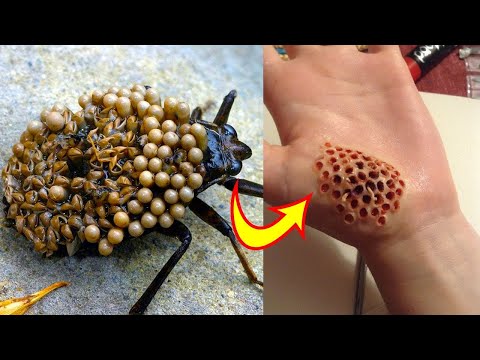 Play this video 10 Most Dangerous Bugs In The World