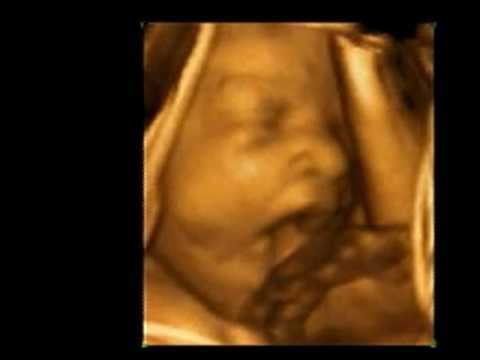 ultrasound 3d 4d - 30 weeks baby boy keep yawning..3D Ultrasound at 30 weeks 3d 4d ultrasound, 3D. 30 Weeks ultrasound.amazing 3d 4d ultrasound session done at A New Conception...