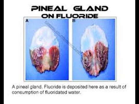 how to eliminate fluoride from body