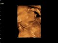 Baby Duer