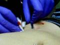 videos de sarah gets a surface hip piercing