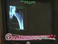 Solo Para Mujeres Prog.17 Chequeo Materno Fetal Part01