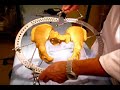 Treatment of pelvic fractures with an Ilizarov frame