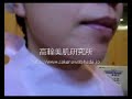 にきび治療　バフライト