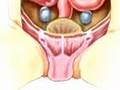 PreOp-Patient-Educat