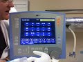ventilator type & modes part 2 ventilator type & modes part 2