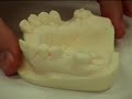 Dental implant surgery training video Dental implant surgery training video