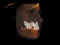 Orthodontics in 3D