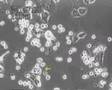 Human granulocytes kill cervical cancer cells