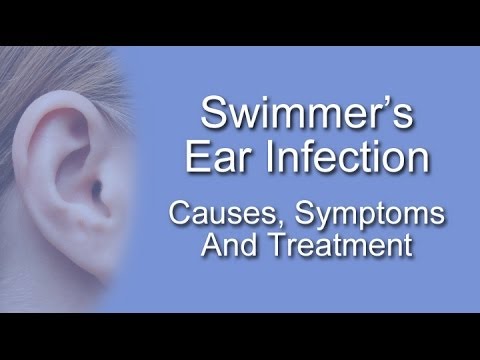 how to treat swimmer's.ear