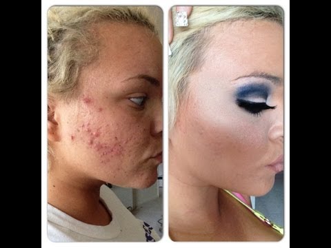 Coverage - OPEN ME ::::::BUY MY BOOK ON AMAZON!!!!! http://www.amazon.com/The-History-Insanity-Trisha-Paytas/dp/1482660067/ref=sr_1_1?ie=UTF8&qid=1371731288&...