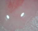 Expanding Biofilm