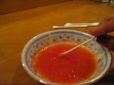 how to remove acne scars